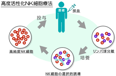 高度活性化NK細胞療法