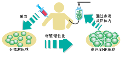 高度活性化NK細胞療法